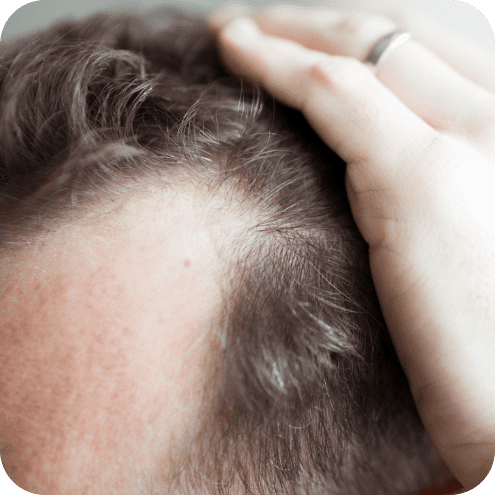 Privatpraxis für Dermatologie und Ästhetik - Haut & Herzlich 4 Haarsprechstunde in Regensburg