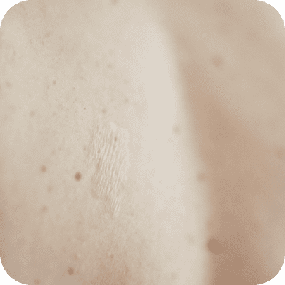 Privatpraxis für Dermatologie und Ästhetik - Haut & Herzlich 10 Rectangle 91 10