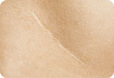 CO2 Laser - LP 3 c02 laser 02