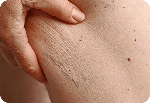 DermaV - LP 2 dermav 01 1