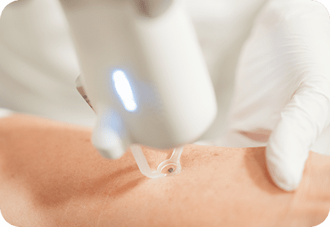 DermaV - LP 3 dermav 01