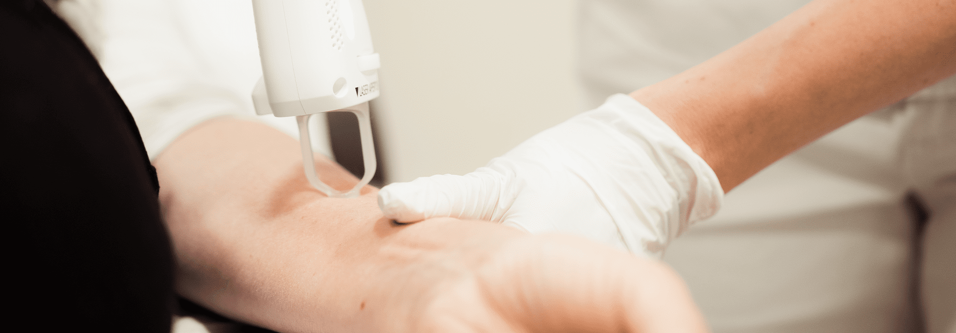 DermaV - LP 1 DermaV Behandlung in Hautarztpraxis