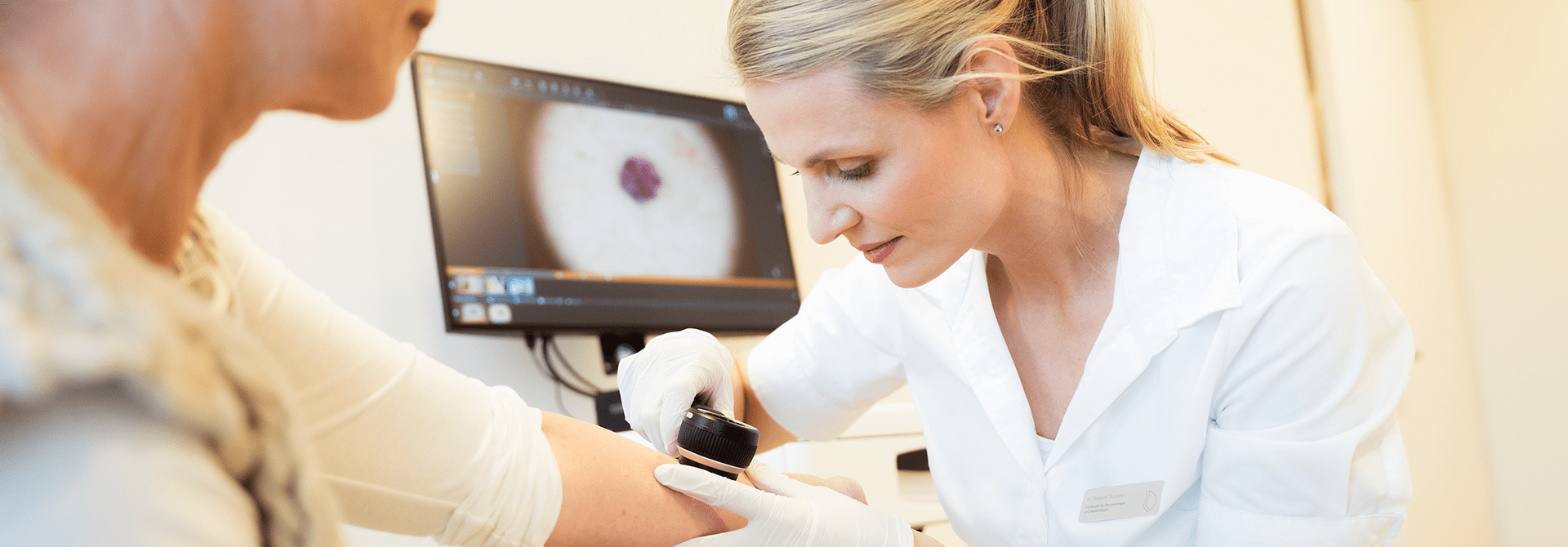 hautkrebsscreening header