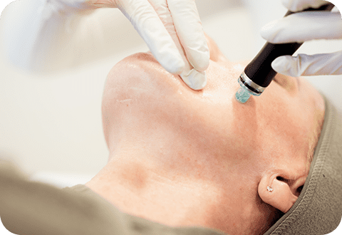 Hydrafacial - LP 5 hydrafacial 03